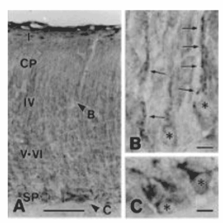 Immunohistochemistry for nucleobindin 2 in neonatal mouse brain with this antibody