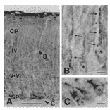 Immunohistochemistry for nucleobindin 2 in neonatal mouse brain with this antibody