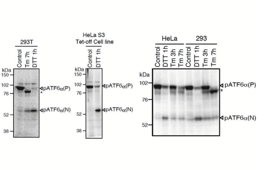 Western blot analysis of human cell extracts using this antibody: Conversion of pATF6?(P) to pATF6?(N) in DTT- or tunicamycin-treated cells.