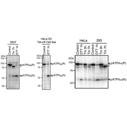 Western blot analysis of human cell extracts using this antibody: Conversion of pATF6?(P) to pATF6?(N) in DTT- or tunicamycin-treated cells.