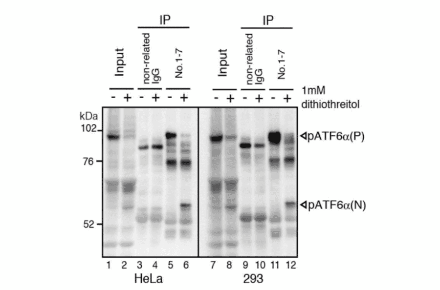 IP-Western blot analysis of human cell extracts using this antibody.