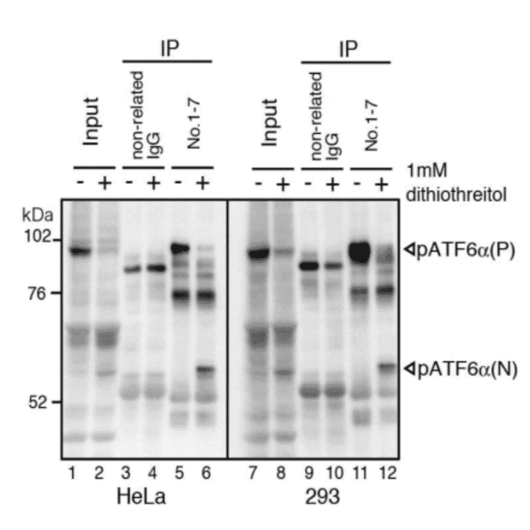 IP-Western blot analysis of human cell extracts using this antibody.