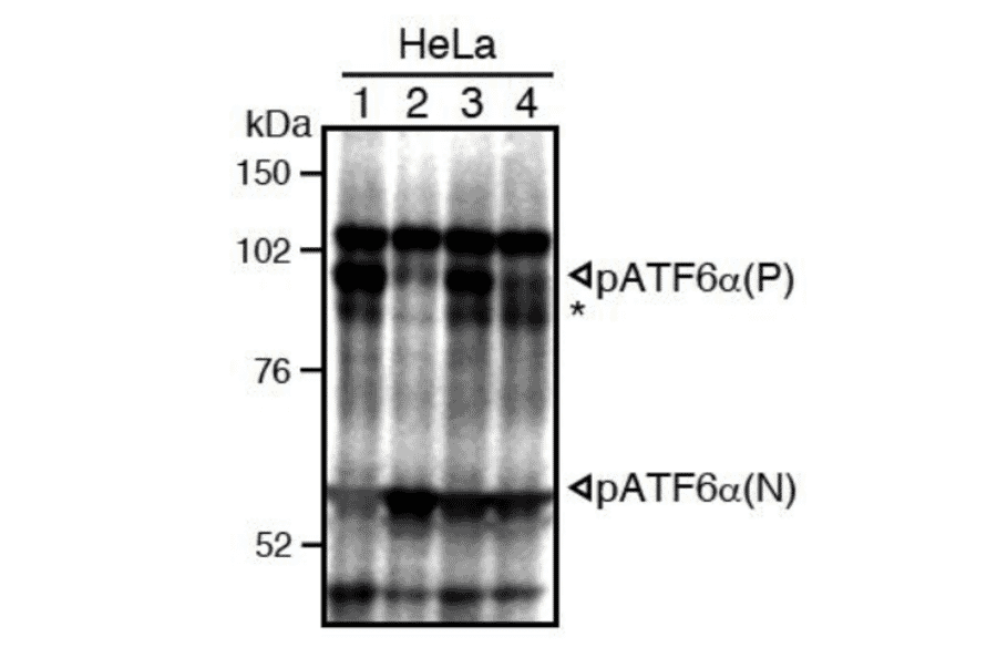 Western blot analysis of human cell extracts using this antibody: Conversion of pATF6?(P) to pATF6?(N) in DTT- or tunicamycin-treated cells.