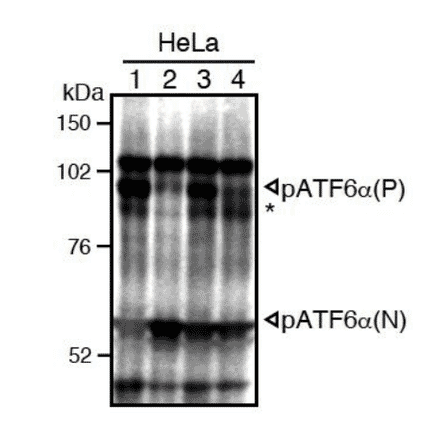 Western blot analysis of human cell extracts using this antibody: Conversion of pATF6?(P) to pATF6?(N) in DTT- or tunicamycin-treated cells.