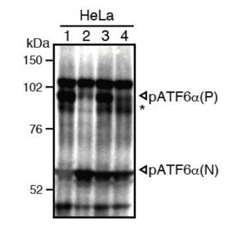 Western blot analysis of mouse cell extracts using this antibody: Conversion of pATF6?(P) to pATF6?(N) in DTT- or tunicamycin-treated cells.