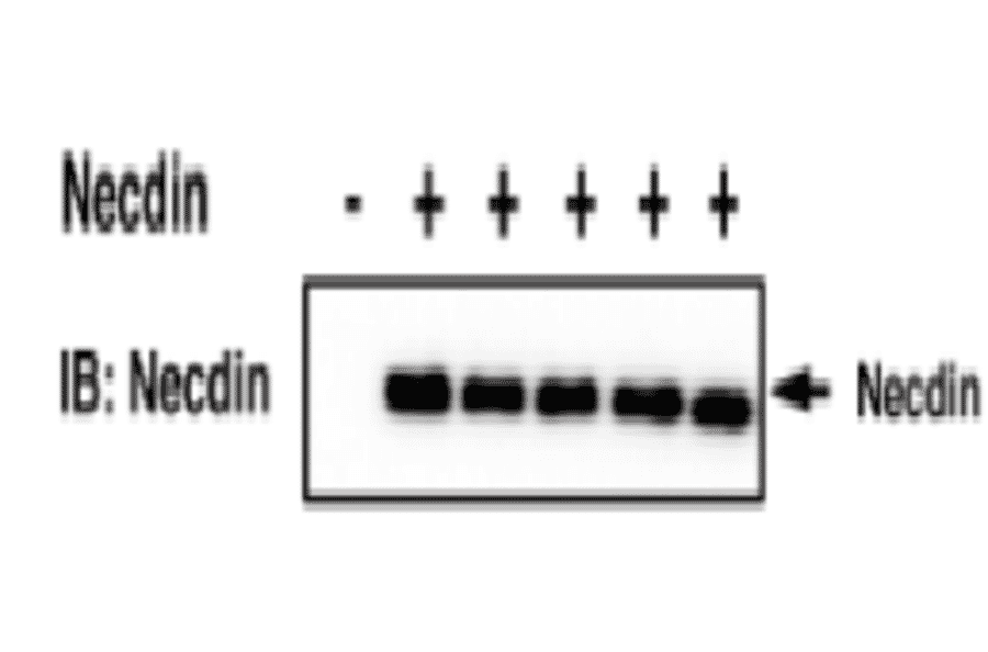 Immunoprecipitation of necdin
