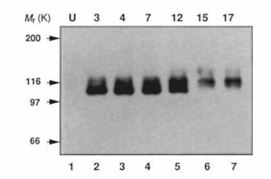 Endogenous expression of APP in mouse P19 cells during neural differentiation was analyzed by Western blotting using this antibody (ref.2).