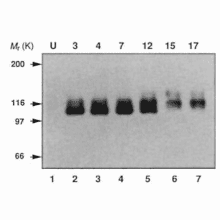 Endogenous expression of APP in mouse P19 cells during neural differentiation was analyzed by Western blotting using this antibody (ref.2).