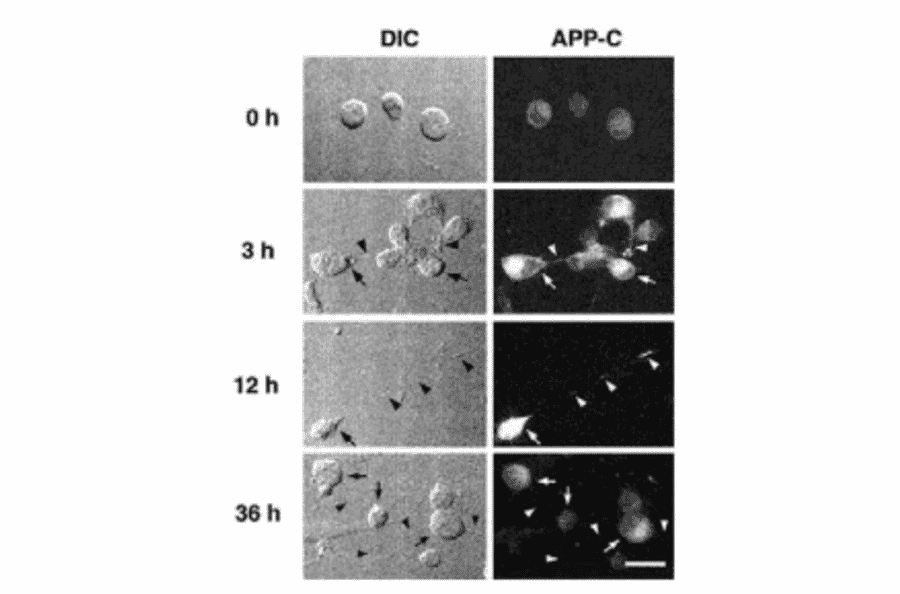 Immunocytochemistry for APP (ref 4).