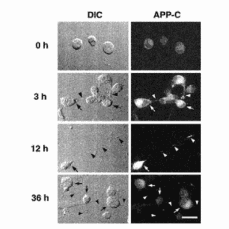 Immunocytochemistry for APP (ref 4).