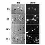 Immunocytochemistry for APP (ref 4).
