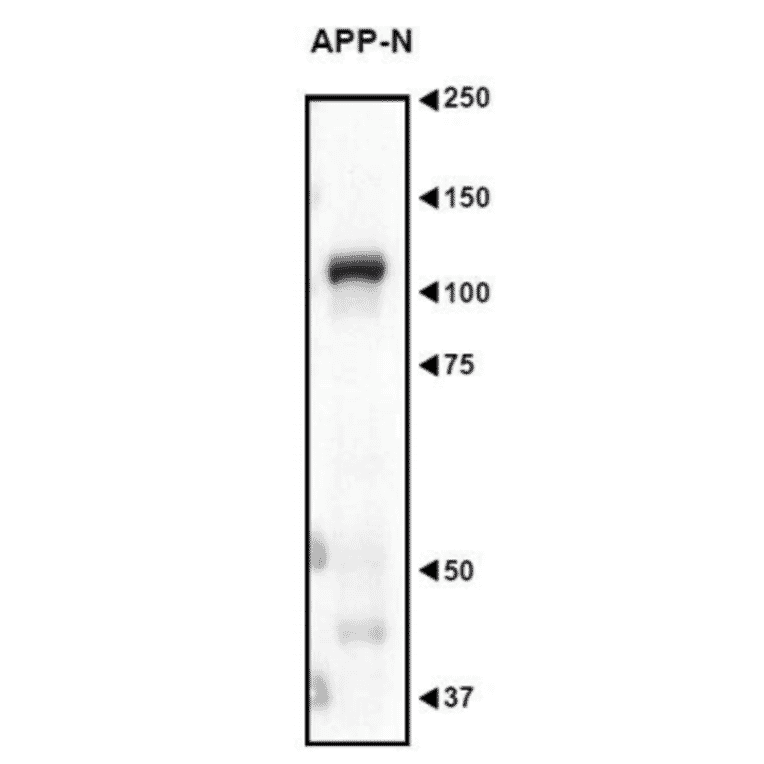 Anti Amyloid Precursor Protein Antibody A449