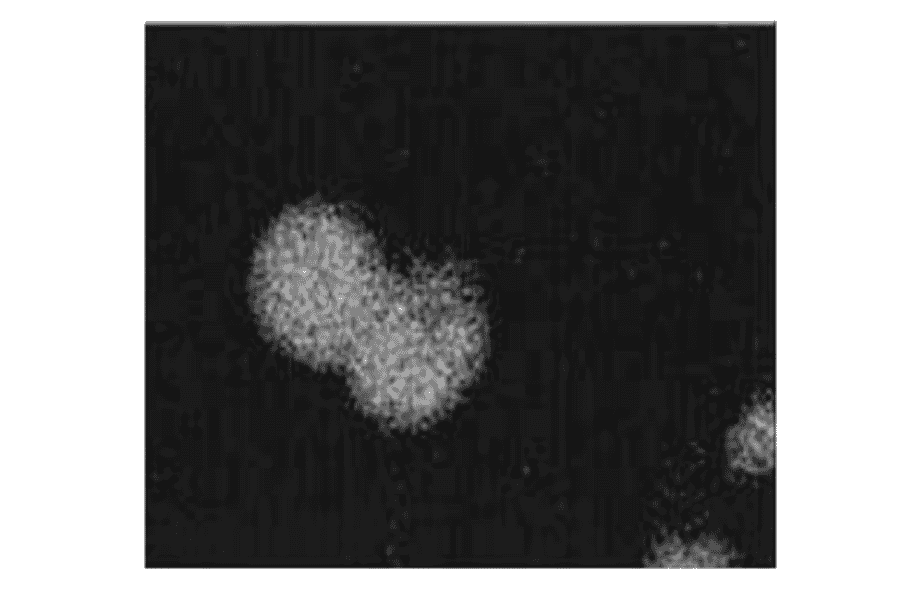 Immunocytochemistry for APP.