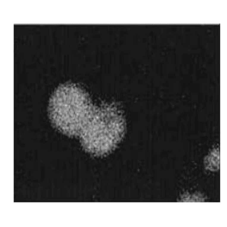 Immunocytochemistry for APP.