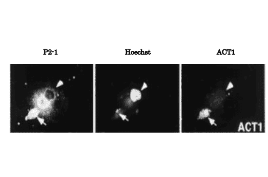 Fig.1 Immunocytochemistry for APP-C31: Specific reactivity of the antibody ACT1 with C-terminal fragment of the caspase 3-cleaved APP.