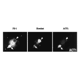 Fig.1 Immunocytochemistry for APP-C31: Specific reactivity of the antibody ACT1 with C-terminal fragment of the caspase 3-cleaved APP.