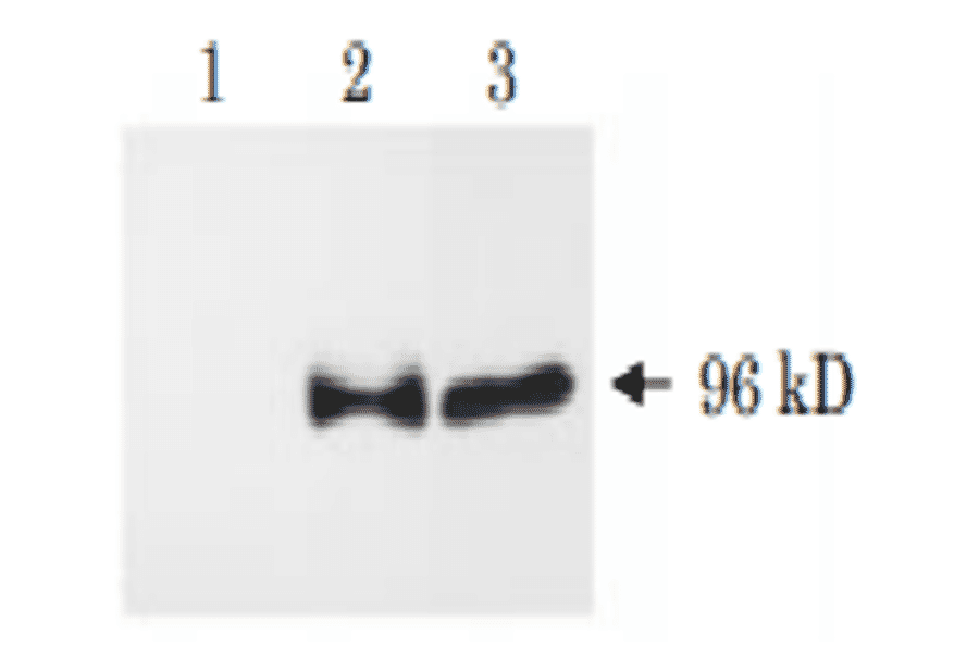 Western blot analysis of APP?C31 . 