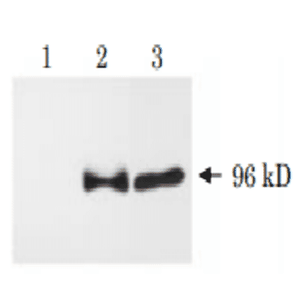Western blot analysis of APP?C31 . 