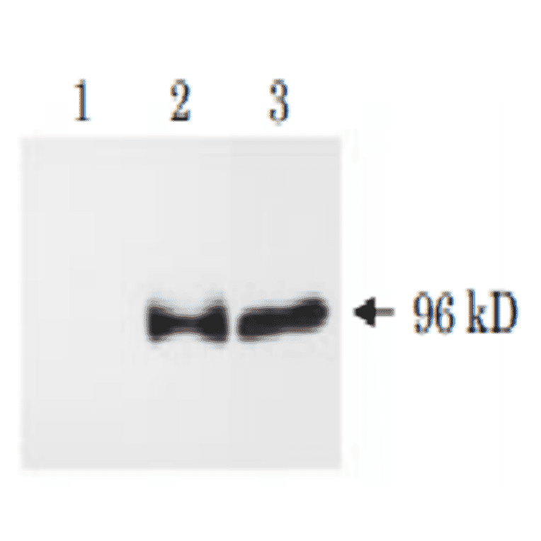 Western blot analysis of APP?C31 . 