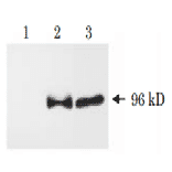 Western blot analysis of APP?C31 . 