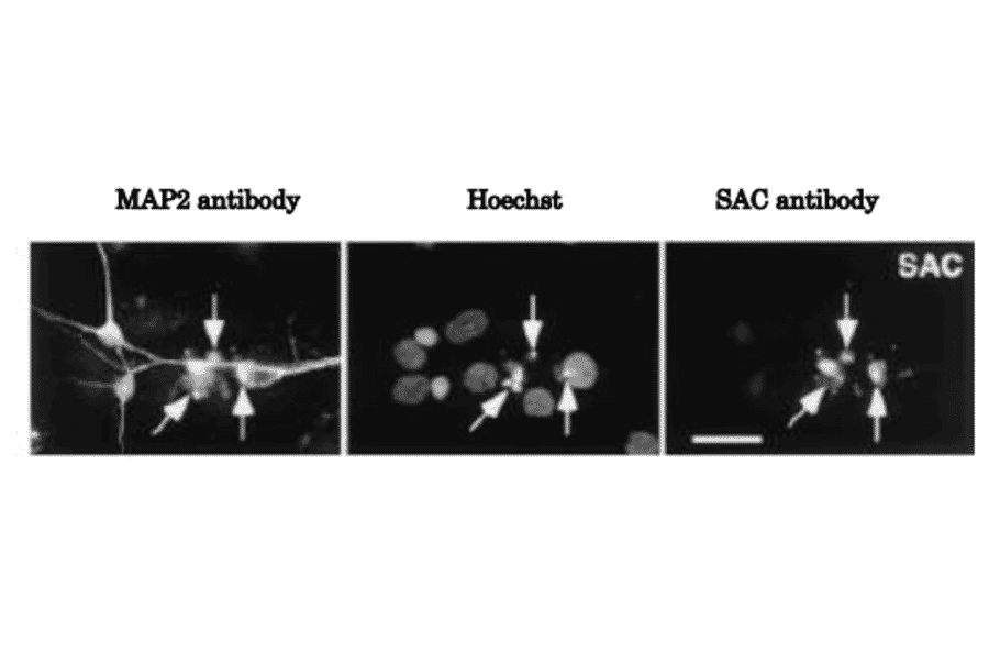 Immunocytochemical analysis of APP?C31. Generation of the caspase-cleaved fragment APP?C31 within neurons induced by serum deprivation.