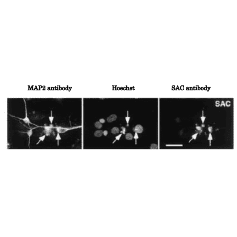 Immunocytochemical analysis of APP?C31. Generation of the caspase-cleaved fragment APP?C31 within neurons induced by serum deprivation.