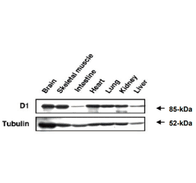 Western blot analysis of MAGE-D1 expression in various organs in mouse embrio.