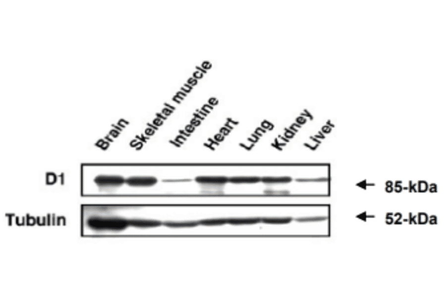Western blot analysis of MAGE-D1 expression in various organs in mouse embrio.