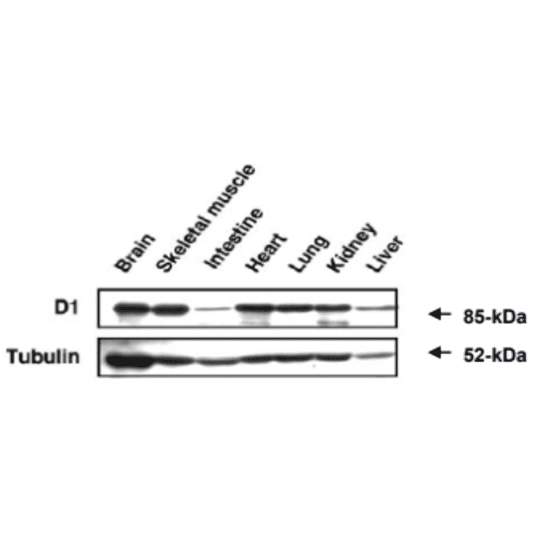 Western blot analysis of MAGE-D1 expression in various organs in mouse embrio.