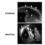 Immunohistochemistry for MAGE-D1 in mouse embroys