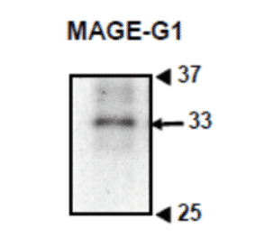 Western blotting of crude extract of mouse embryonic cells with anti-MAGE-G1 antibody (MG1).