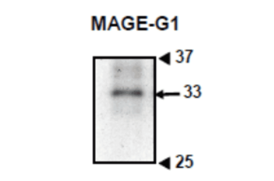 Western blotting of crude extract of mouse embryonic cells with anti-MAGE-G1 antibody (MG1).