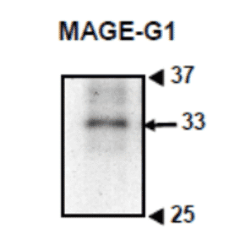 Western blotting of crude extract of mouse embryonic cells with anti-MAGE-G1 antibody (MG1).