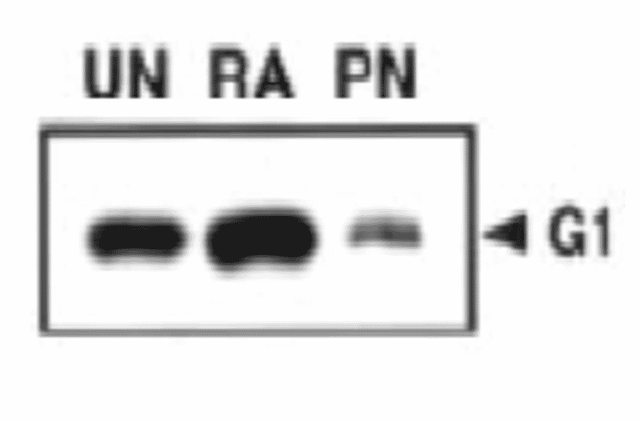 Western blot analysis of MAGE-G1 at different stages of neural differentiation.with this antibody .