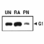 Western blot analysis of MAGE-G1 at different stages of neural differentiation.with this antibody .