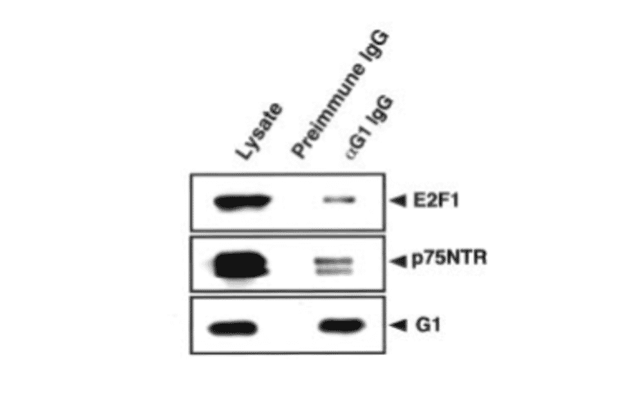 Immunoaffinity purification of the protein complex with anti-MAGE-G1 antibody.
