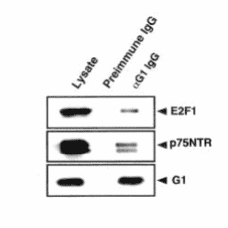 Immunoaffinity purification of the protein complex with anti-MAGE-G1 antibody.