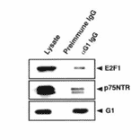 Immunoaffinity purification of the protein complex with anti-MAGE-G1 antibody.