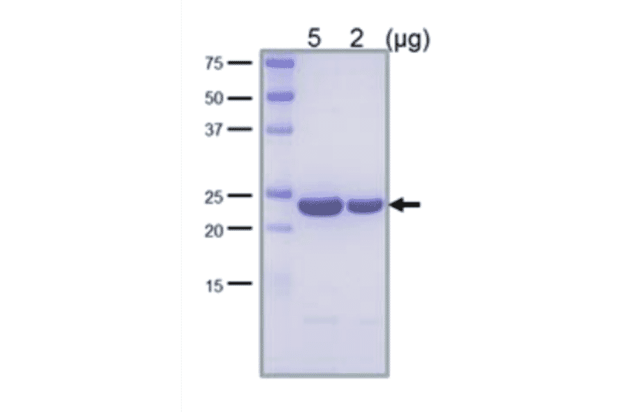 SDS-PAGE analysis of the purified LexA protein.