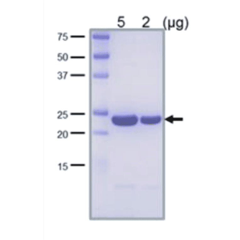 SDS-PAGE analysis of the purified LexA protein.