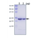 SDS-PAGE analysis of the purified LexA protein.