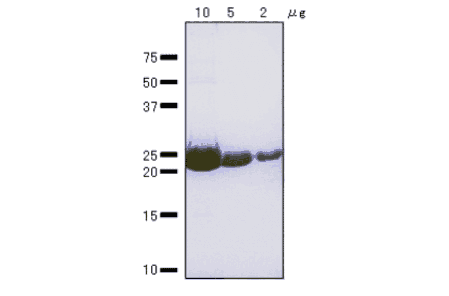 SDS-Polyacrylamide gel electrophoresis of RuvA protein.