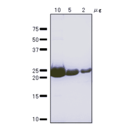 SDS-Polyacrylamide gel electrophoresis of RuvA protein.