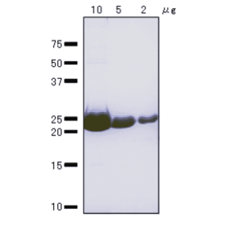 SDS-Polyacrylamide gel electrophoresis of RuvA protein.