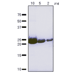 SDS-Polyacrylamide gel electrophoresis of RuvA protein.