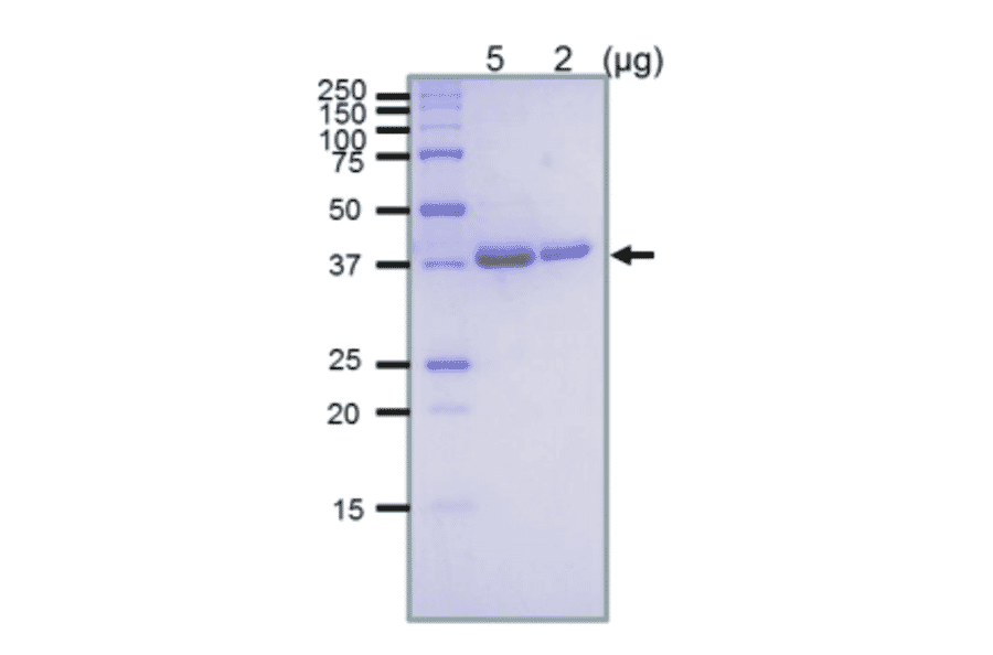 SDS-PAGE analysis of the purified RuvB protein.