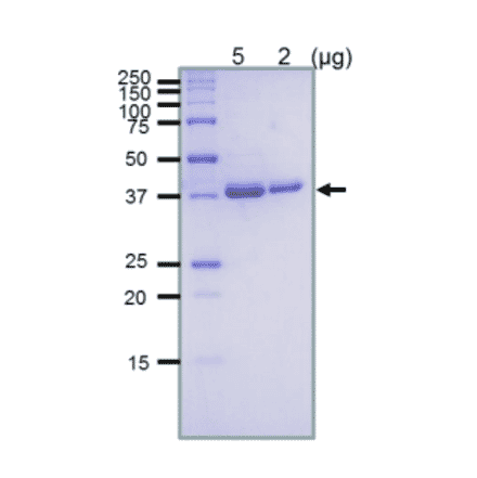 SDS-PAGE analysis of the purified RuvB protein.