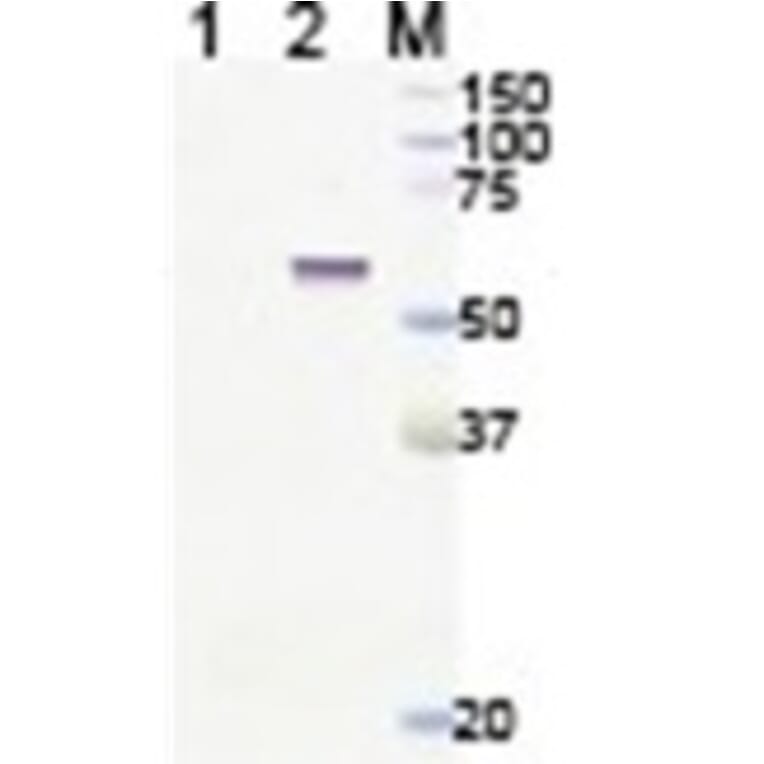 Western Blot - Anti-Lgi4 Antibody (011311H12) - Antibodies.com