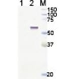 Western Blot - Anti-Lgi4 Antibody (011311H12) - Antibodies.com