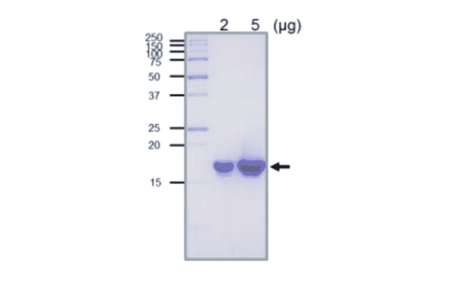 SDS-PAGE analysis of the purified RuvC protein.